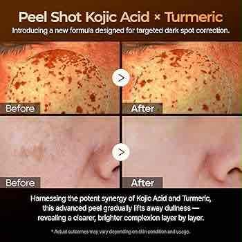 Dr. Melaxin Peel Shot Exfoliating Kojic Acid Turmeric Serum 80 ml